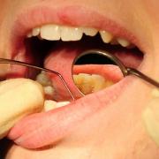 Scammers are targeting people in Norfolk desperate for NHS dentists